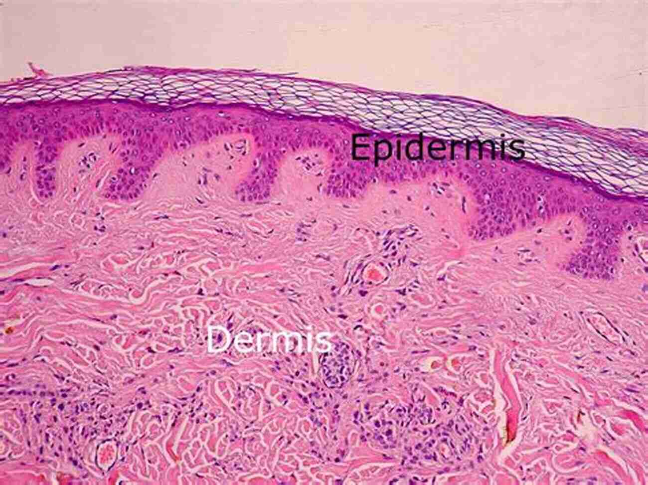 Cross Section Of The Dermis THE SKIN AND OTHER LAYERS